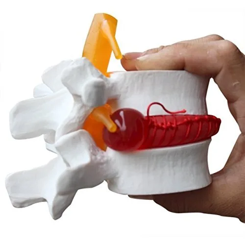 DENTAL Color blanco oral 1:1.5 vértebras lumbares humanas anatómicas degenerativas lumbares modelo de columna vertebral humana US Stock